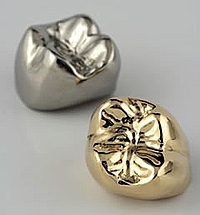 Цельнолитая титановая коронка и коронка с напылением из нитрида титана